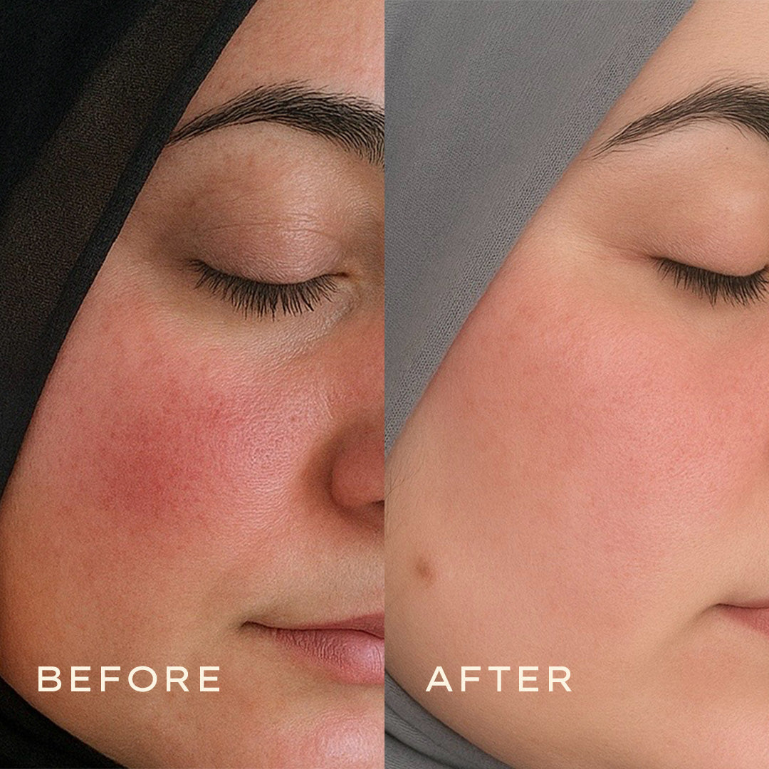 Calendula2025_11_Before  After 1080x1080 Creamjpg