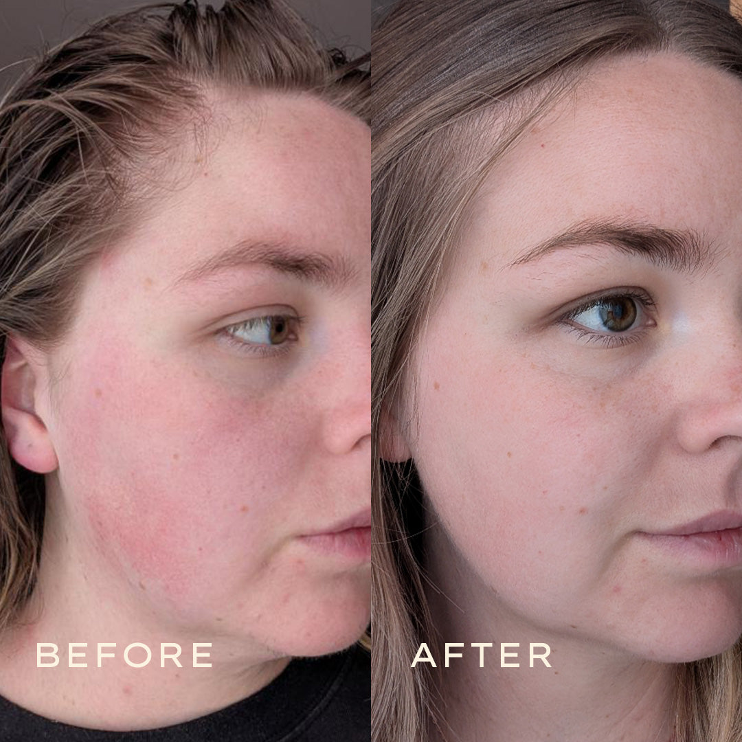 Calendula2025_11_Before  After 1080x1080 Toner 2jpg